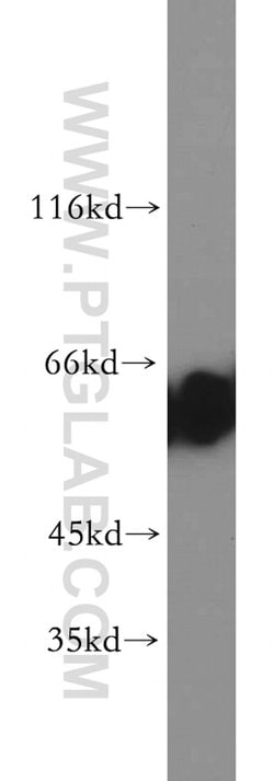 CBX2 Rabbit anti-Human, Mouse, Rat, Polyclonal, Proteintech 150 &mu;L;
