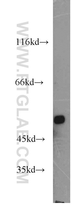 FDXR Rabbit anti-Human, Mouse, Rat, Polyclonal, Proteintech 150 &mu;L;
