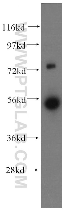 FDXR Rabbit anti-Human, Mouse, Rat, Polyclonal, Proteintech 150 &mu;L;
