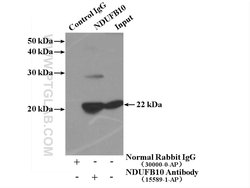 NDUFB10 Rabbit anti-Human, Mouse, Rat, Polyclonal, Proteintech:Antibodies:Primary
