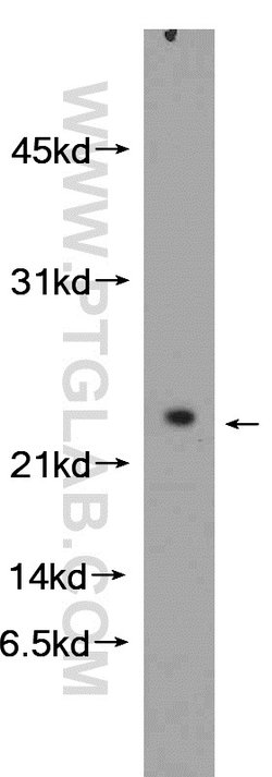 NDUFB10 Rabbit anti-Human, Mouse, Rat, Polyclonal, Proteintech:Antibodies:Primary