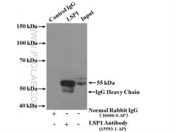 LSP1 Rabbit anti-Human, Polyclonal, Proteintech 150 μL; Unconjugated:Antibodies,