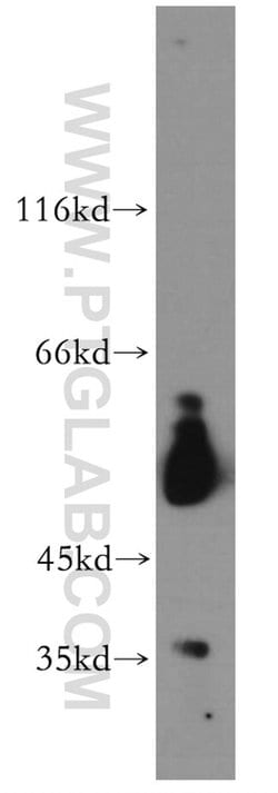 VRK3 Rabbit anti-Human, Polyclonal, Proteintech 150 &mu;L; Unconjugated:Antibodies,