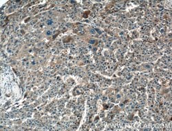 HAS3 Rabbit anti-Human, Mouse, Rat, Polyclonal, Proteintech:Antibodies:Primary