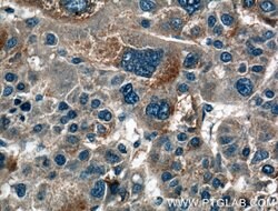 HAS3 Rabbit anti-Human, Mouse, Rat, Polyclonal, Proteintech:Antibodies:Primary