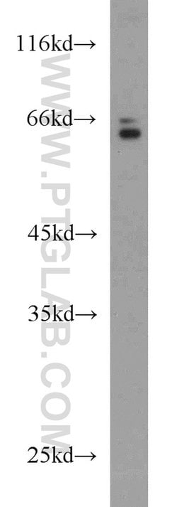 HAS3 Rabbit anti-Human, Mouse, Rat, Polyclonal, Proteintech:Antibodies:Primary