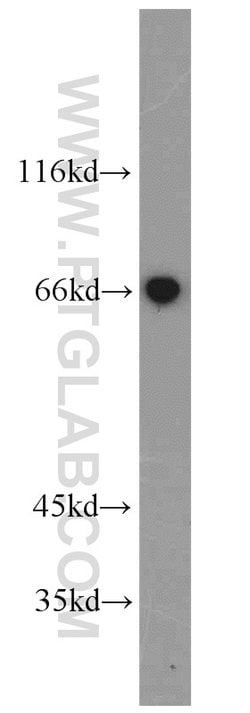 HAS3 Rabbit anti-Human, Mouse, Rat, Polyclonal, Proteintech:Antibodies:Primary