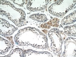 SF4 Rabbit anti-Human, Mouse, Rat, Polyclonal, Proteintech:Antibodies:Primary