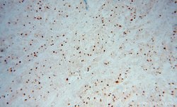 PRC1 Rabbit anti-Human, Polyclonal, Proteintech 20 &mu;L; Unconjugated:Antibodies,