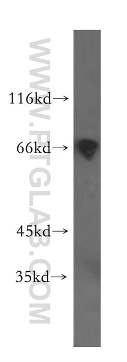 PRC1 Rabbit anti-Human, Polyclonal, Proteintech 20 &mu;L; Unconjugated:Antibodies,