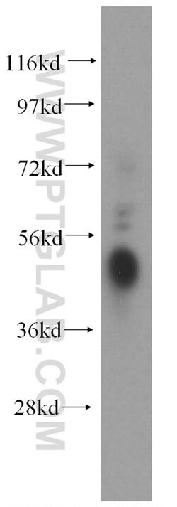FCGR2A / CD32a Rabbit anti-Human, Polyclonal, Proteintech:Antibodies:Primary
