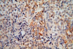 EXOSC5 Rabbit anti-Human, Rat, Polyclonal, Proteintech:Antibodies:Primary