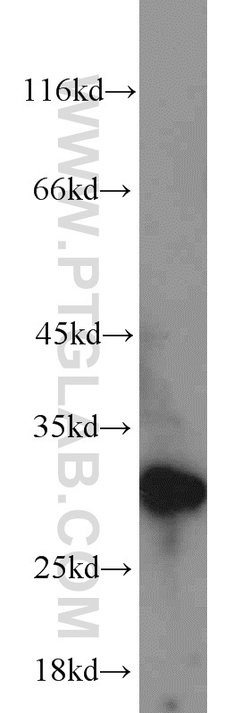 EXOSC5 Rabbit anti-Human, Rat, Polyclonal, Proteintech:Antibodies:Primary