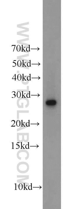 EXOSC5 Rabbit anti-Human, Rat, Polyclonal, Proteintech:Antibodies:Primary