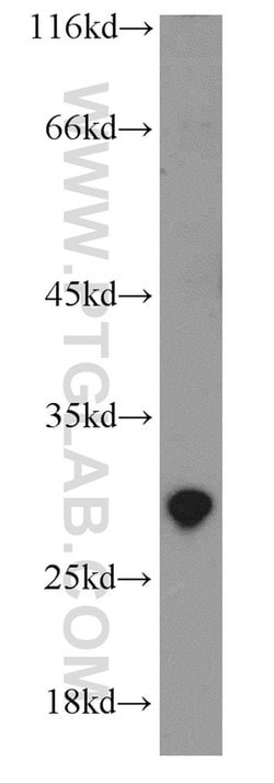 EXOSC5 Rabbit anti-Human, Rat, Polyclonal, Proteintech:Antibodies:Primary