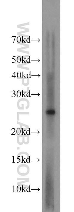 EXOSC5 Rabbit anti-Human, Rat, Polyclonal, Proteintech:Antibodies:Primary