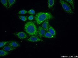 ACOT2 Rabbit anti-Human, Mouse, Rat, Polyclonal, Proteintech 150 &mu;L;