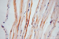 ACOT2 Rabbit anti-Human, Mouse, Rat, Polyclonal, Proteintech 150 &mu;L;