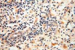 ACOT2 Rabbit anti-Human, Mouse, Rat, Polyclonal, Proteintech 150 &mu;L;