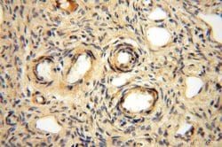 ACOT2 Rabbit anti-Human, Mouse, Rat, Polyclonal, Proteintech 150 &mu;L;