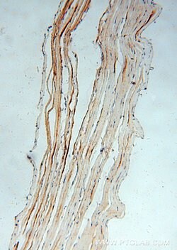 ACOT2 Rabbit anti-Human, Mouse, Rat, Polyclonal, Proteintech 150 &mu;L;