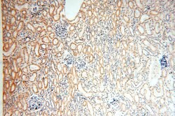 ACOT2 Rabbit anti-Human, Mouse, Rat, Polyclonal, Proteintech 150 &mu;L;