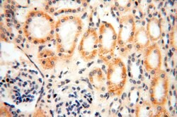ACOT2 Rabbit anti-Human, Mouse, Rat, Polyclonal, Proteintech 150 &mu;L;