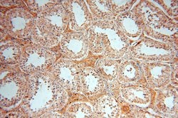 ACOT2 Rabbit anti-Human, Mouse, Rat, Polyclonal, Proteintech 150 &mu;L;