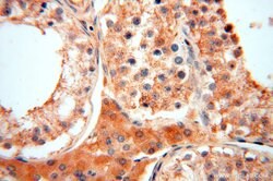 ACOT2 Rabbit anti-Human, Mouse, Rat, Polyclonal, Proteintech 150 &mu;L;