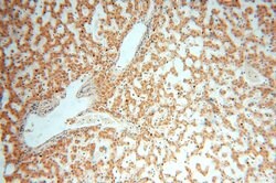 ACOT2 Rabbit anti-Human, Mouse, Rat, Polyclonal, Proteintech 150 &mu;L;