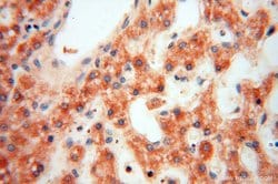 ACOT2 Rabbit anti-Human, Mouse, Rat, Polyclonal, Proteintech 150 &mu;L;