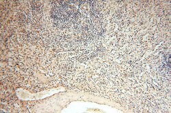 ACOT2 Rabbit anti-Human, Mouse, Rat, Polyclonal, Proteintech 150 &mu;L;