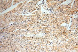ACOT2 Rabbit anti-Human, Mouse, Rat, Polyclonal, Proteintech 150 &mu;L;