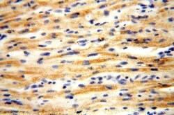 ACOT2 Rabbit anti-Human, Mouse, Rat, Polyclonal, Proteintech 150 &mu;L;