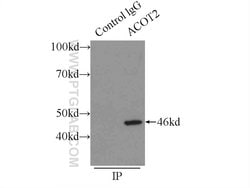 ACOT2 Rabbit anti-Human, Mouse, Rat, Polyclonal, Proteintech 150 &mu;L;