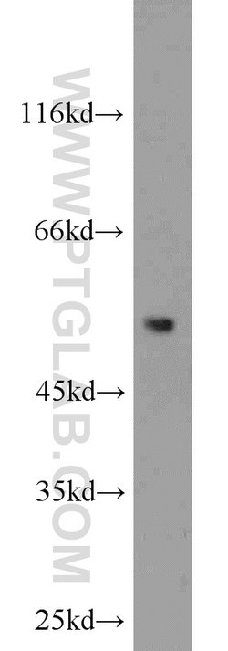 ACOT2 Rabbit anti-Human, Mouse, Rat, Polyclonal, Proteintech 150 &mu;L;