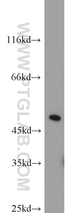ACOT2 Rabbit anti-Human, Mouse, Rat, Polyclonal, Proteintech 150 &mu;L;