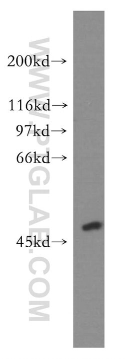 ACOT2 Rabbit anti-Human, Mouse, Rat, Polyclonal, Proteintech 150 &mu;L;