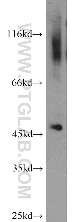 ACOT2 Rabbit anti-Human, Mouse, Rat, Polyclonal, Proteintech 150 &mu;L;