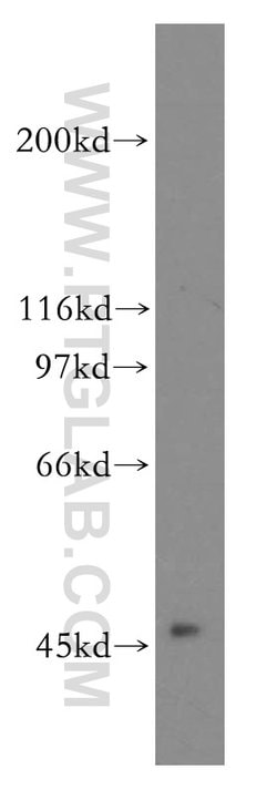ACOT2 Rabbit anti-Human, Mouse, Rat, Polyclonal, Proteintech 150 &mu;L;