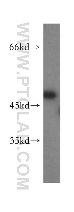 ACOT2 Rabbit anti-Human, Mouse, Rat, Polyclonal, Proteintech 150 &mu;L;