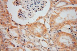 OPA3 Rabbit anti-Human, Mouse, Rat, Polyclonal, Proteintech:Antibodies:Primary