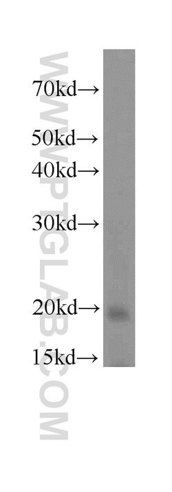 OPA3 Rabbit anti-Human, Mouse, Rat, Polyclonal, Proteintech:Antibodies:Primary