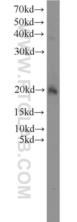 OPA3 Rabbit anti-Human, Mouse, Rat, Polyclonal, Proteintech:Antibodies:Primary