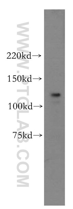 POLD1 Rabbit anti-Human, Mouse, Rat, Polyclonal, Proteintech 150 &mu;L;