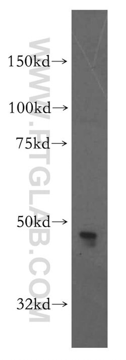 CADM3 Rabbit anti-Human, Mouse, Rat, Polyclonal, Proteintech 150 &mu;L | Buy Online | Proteintech Group Inc | Fisher Scientific