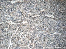 RAB14 Rabbit anti-Human, Mouse, Rat, Polyclonal, Proteintech 150 &mu;L;