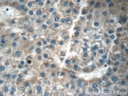 RAB14 Rabbit anti-Human, Mouse, Rat, Polyclonal, Proteintech 150 &mu;L;