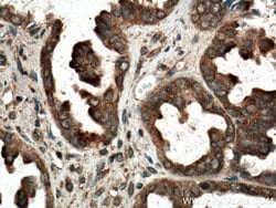 RAB14 Rabbit anti-Human, Mouse, Rat, Polyclonal, Proteintech 150 &mu;L;
