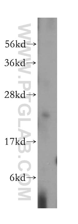 RAB14 Rabbit anti-Human, Mouse, Rat, Polyclonal, Proteintech 150 &mu;L;